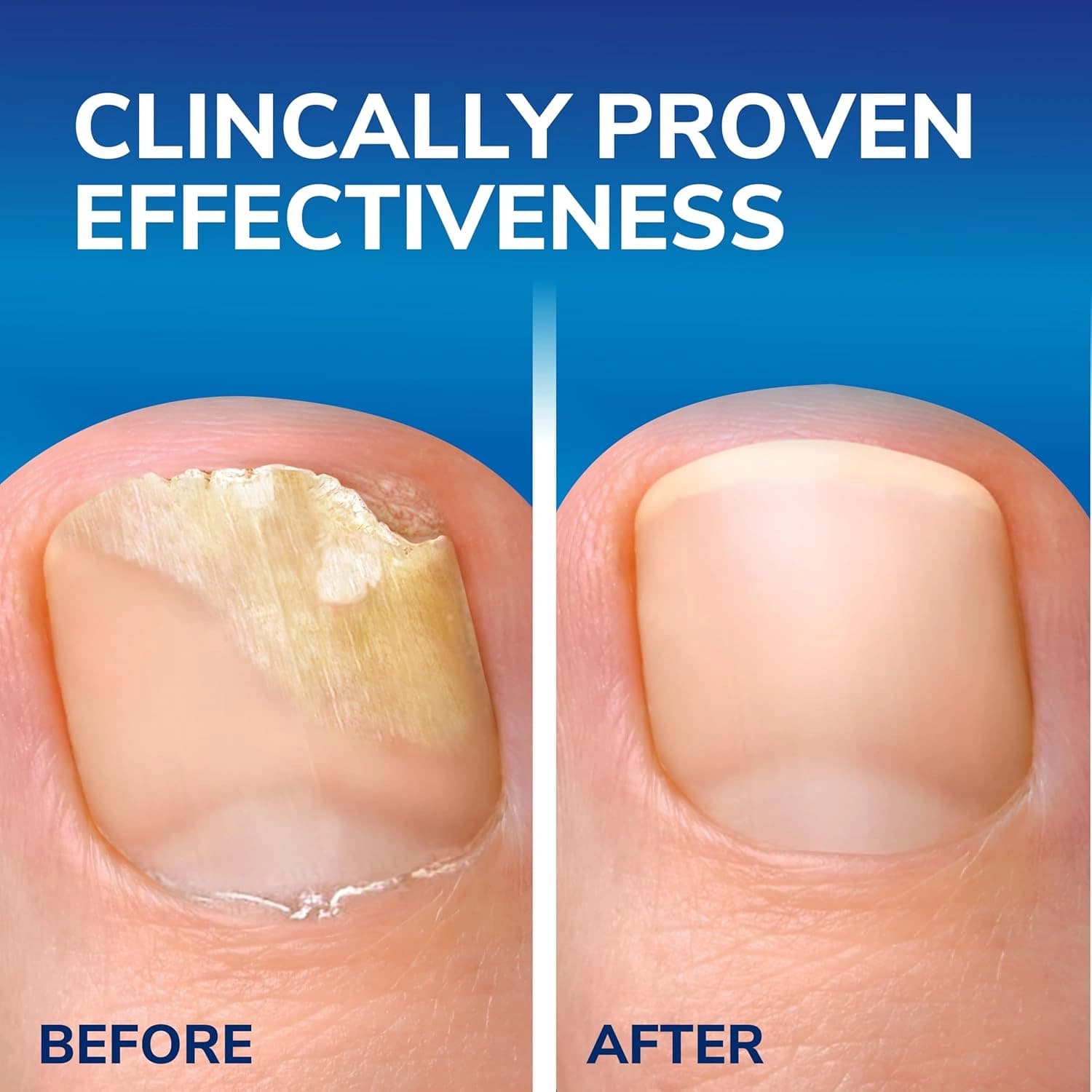Scholl Fungal Nail Treatment 3.8ml