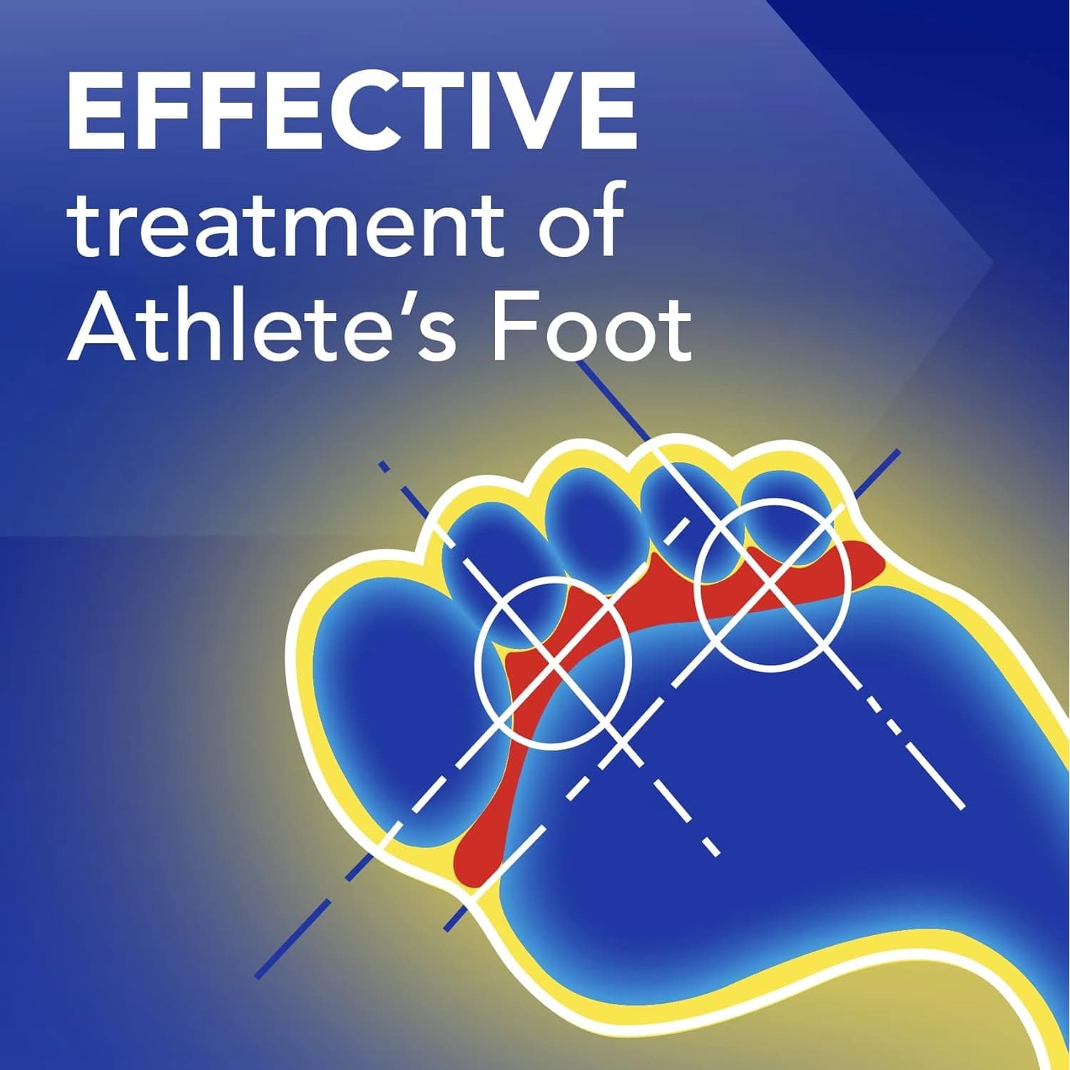 Daktarin Aktv Cream For Athletes Foot 15g