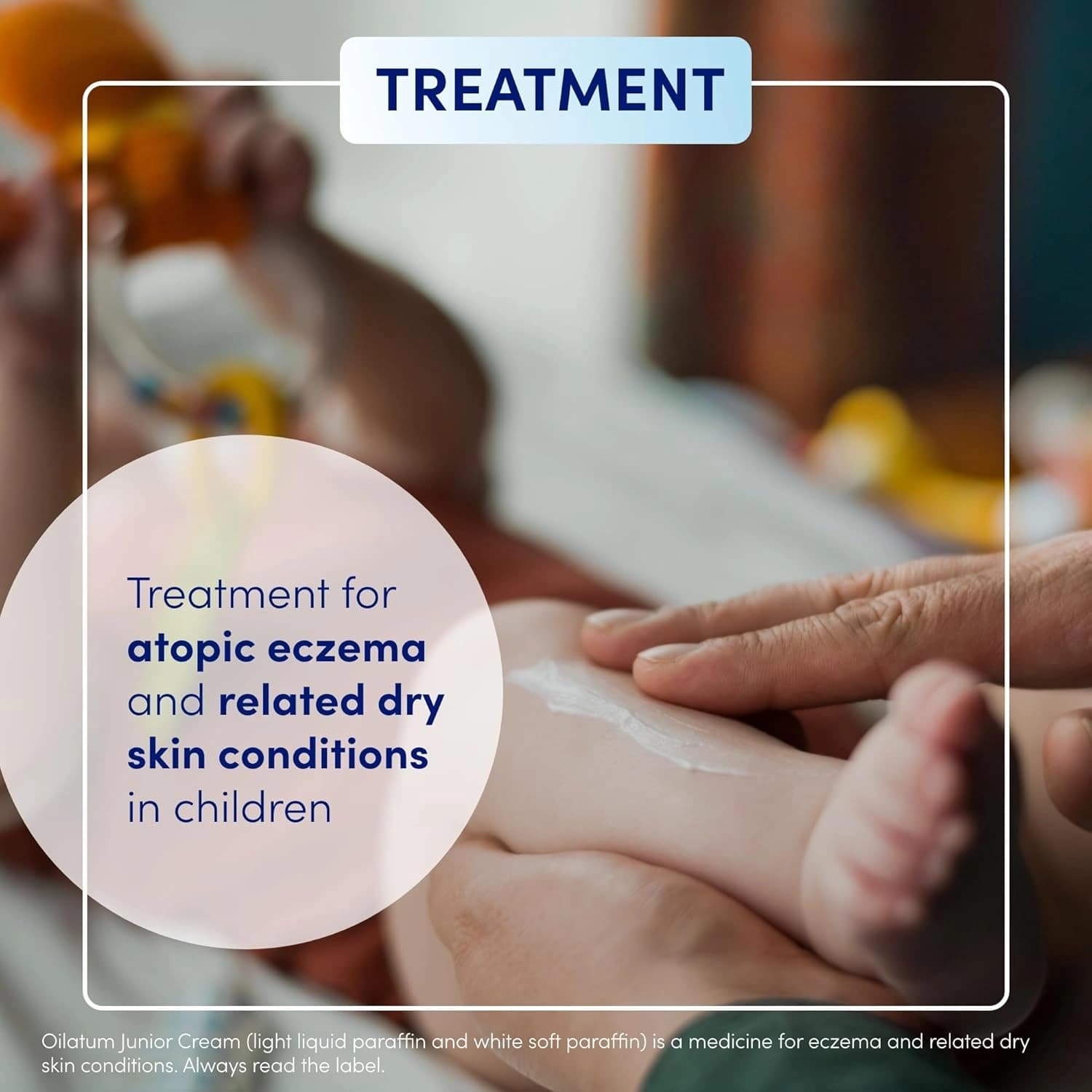 Oilatum Junior Cream for Eczema 350ml