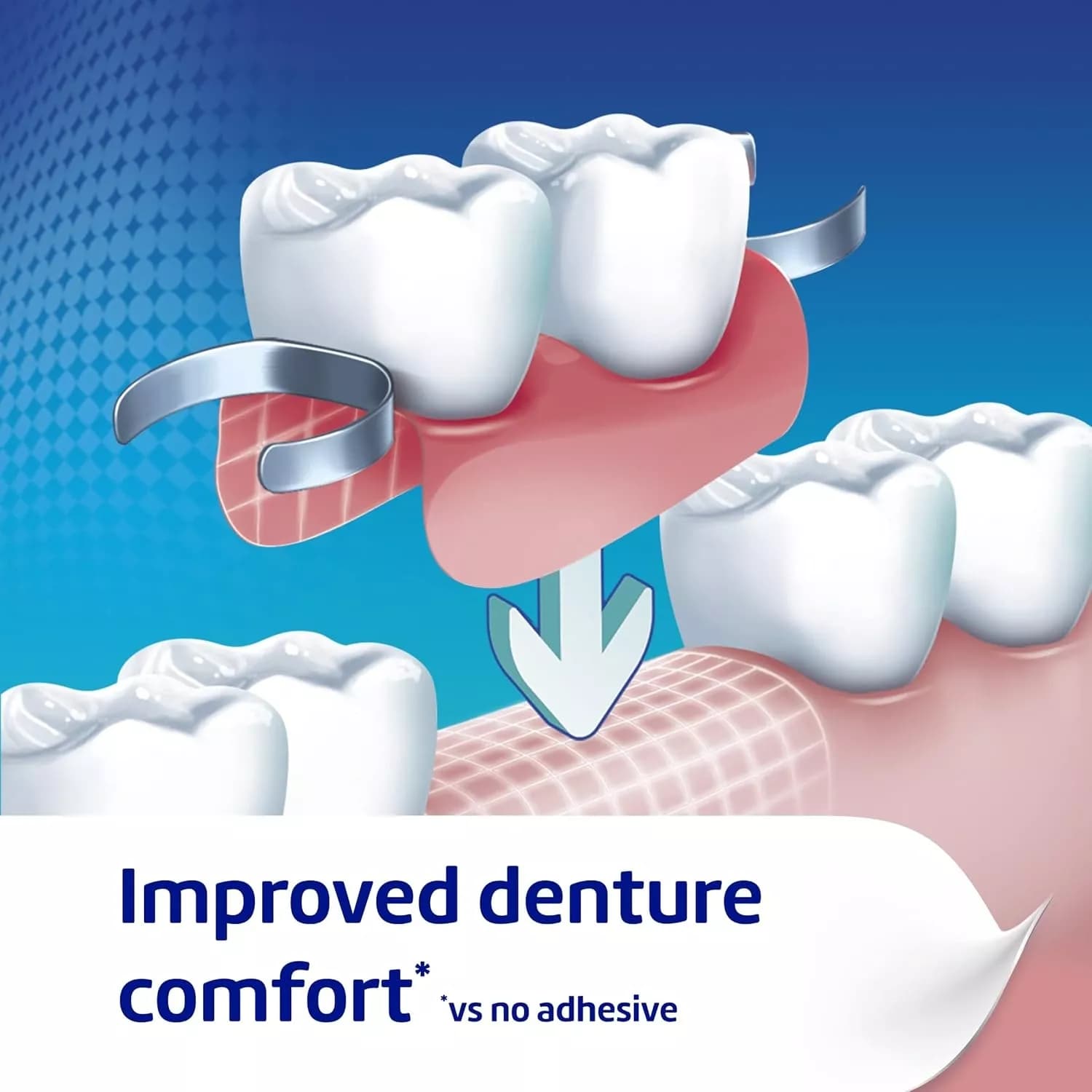 Poligrip Denture Adhesive Fixative Cream 40g
