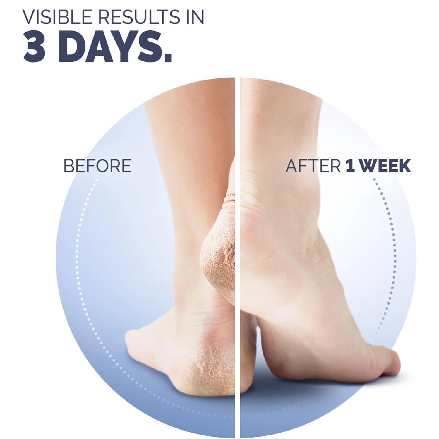 Scholl Cracked Heel Skin Repair Balm Cream 60ml